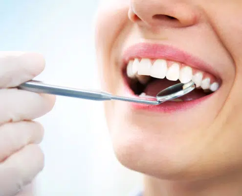 Periodontal Maintenance Care