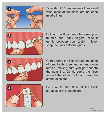 How to Floss Your Teeth Effectively