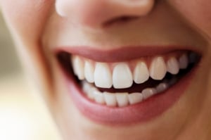Gum Graft Gum Grafting Melbourne